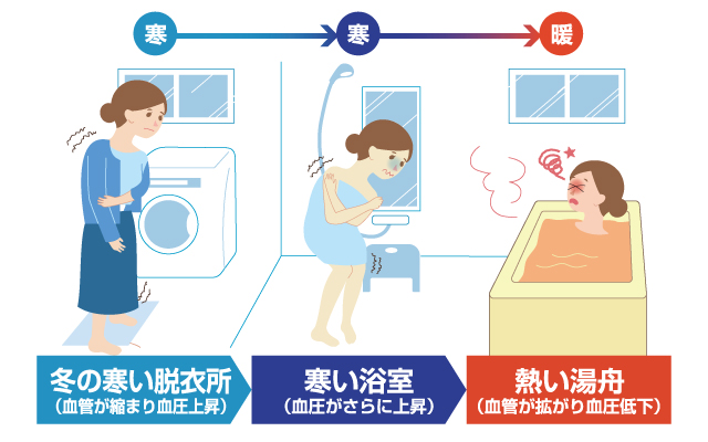 冬のお風呂は要注意 ヒートショック対策 お風呂life わかさ生活コラム わかさ生活