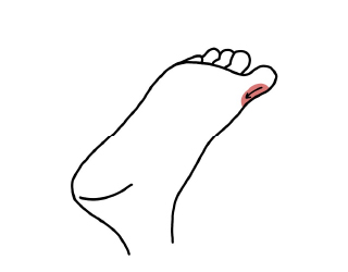 頸椎のポイント