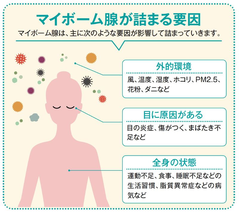 マイボーム腺が詰まる要因