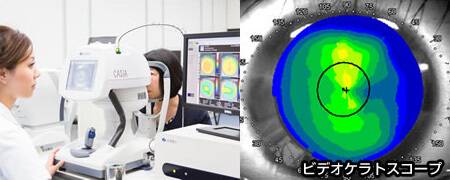 角膜形状解析